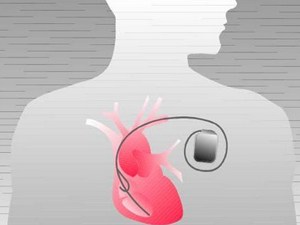 Cardiac-Implants-Devices_pi