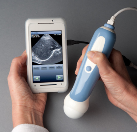 portable-ultrasound