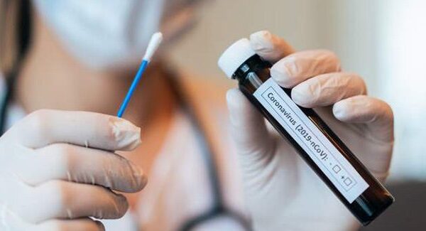 Weak COVID-19 Testing Could Worsen the Pandemic in Latam